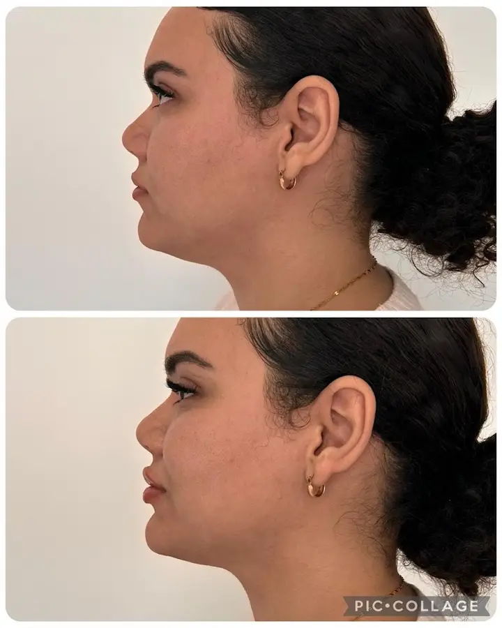 Avaliação estética